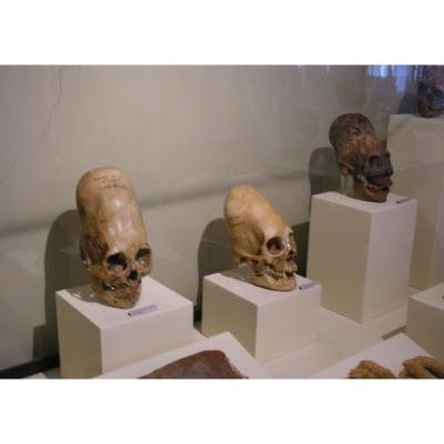 Elongated head skulls from Peru. Regional Museum of Ica city.
