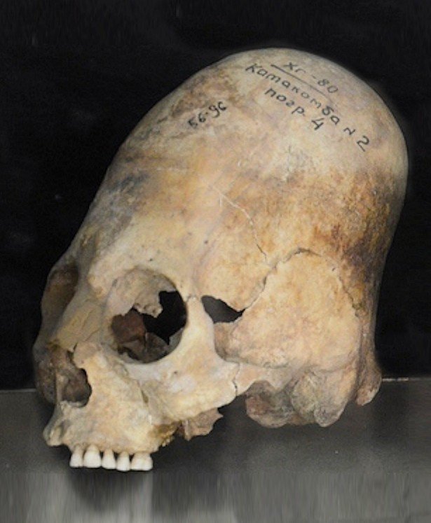 Elongated skull 600-800 CE from Afrasiab Museum